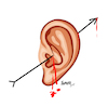 Cartoon: Trump s ear (small) by ismail dogan tagged donald,trump